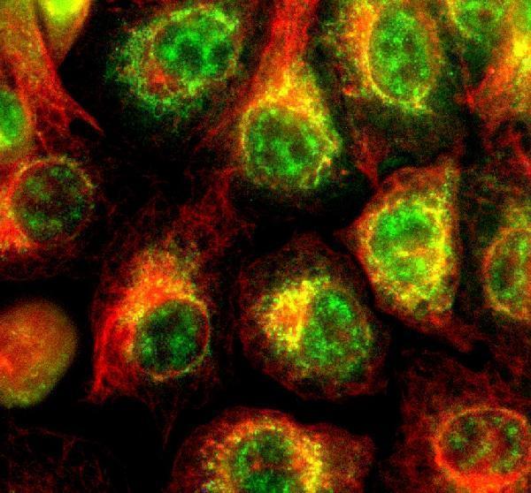 a11593 1 timm10 primary antibodies if testing 2