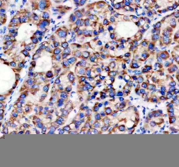 a11593 1 timm10 primary antibodies ihc testing 1