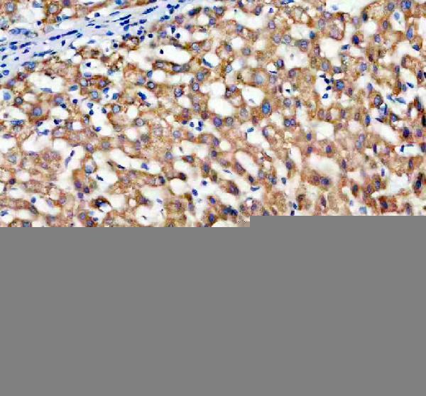 a11593 1 timm10 primary antibodies ihc testing 2