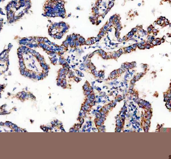 a11593 1 timm10 primary antibodies ihc testing 3