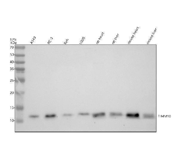 a11593 1 timm10 primary antibodies wb testing 1
