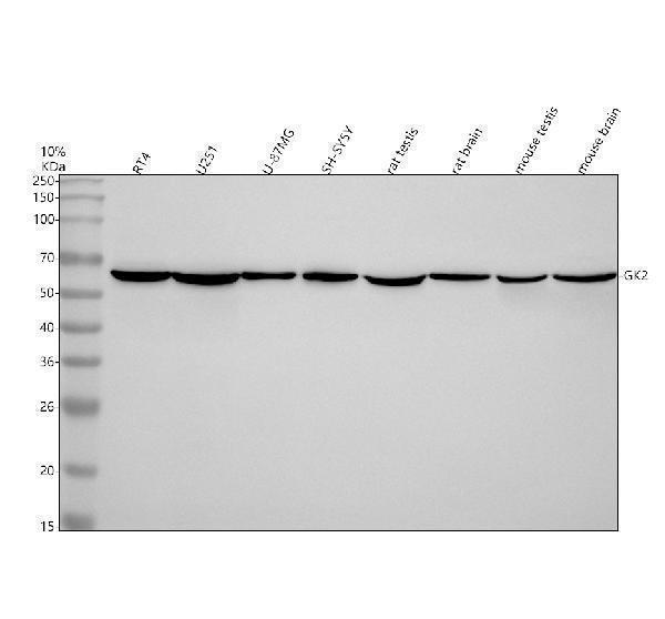  Western blot analysis of GK2 using anti-GK2 antibody (A11596-3)