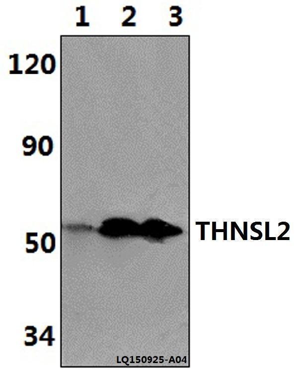 Western blot (WB) analysis of THNSL2 polyclonal antibody at 1:500 dilution
Lane1:HepG2 whole cell lysate(40ug)
Lane2:H9C2 whole cell lysate(40ug)
Lane3:RAW264