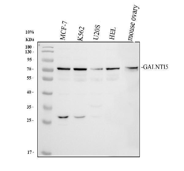  Western blot analysis of GALNT15 using anti-GALNT15 antibody (A11598-1)