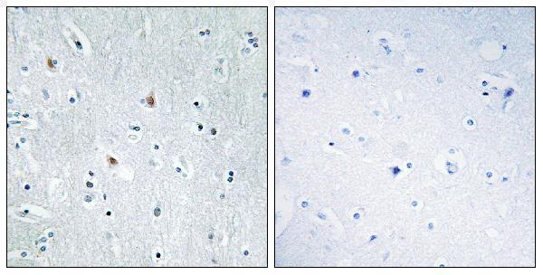 a11606 sox12 primary antibodies ihc testing 1