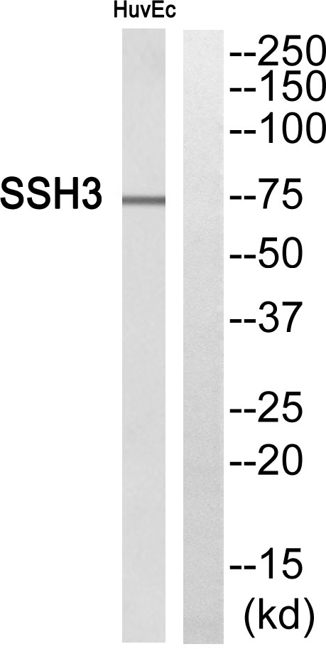 Western blot analysis of SSH3 Antibody