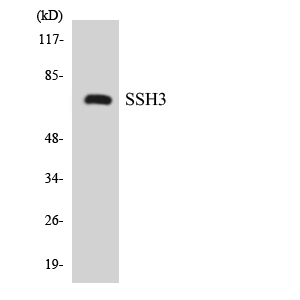 Western blot analysis of the lysates from K562 cells using SSH3 antibody