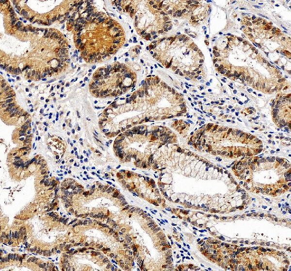 a11611 2 polr3d primary antibodies ihc testing 1