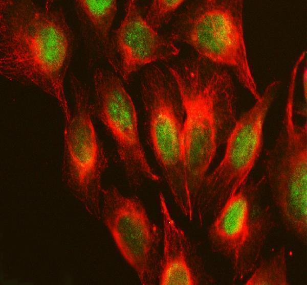 a11612 2 rps19bp1 primary antibodies if testing 2