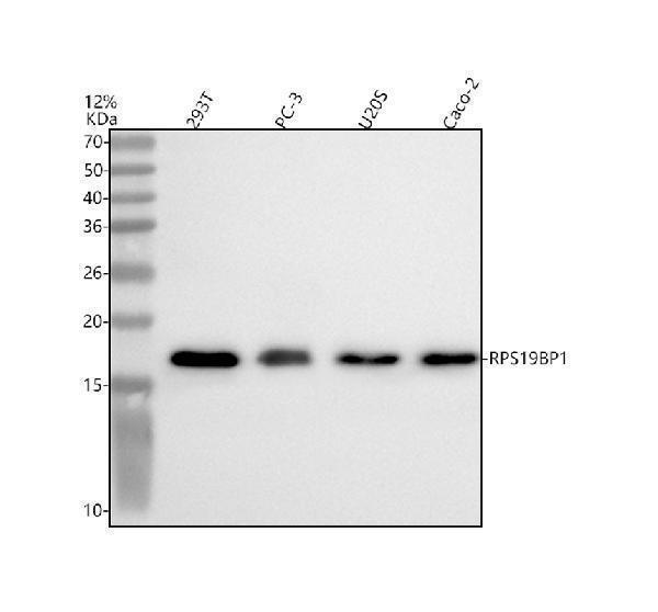 a11612 2 rps19bp1 primary antibodies wb testing 1