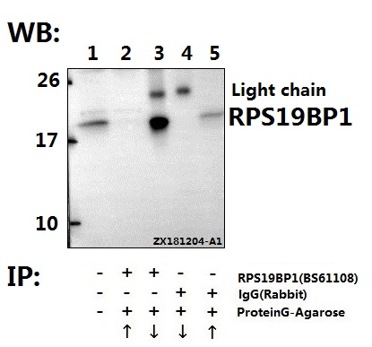 a11612 rps19bp1 primary antiboties ip testing 3