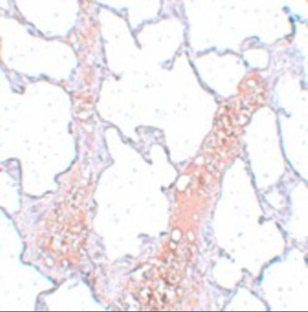 a11618 reep2 primary antibodies ihc testing 2