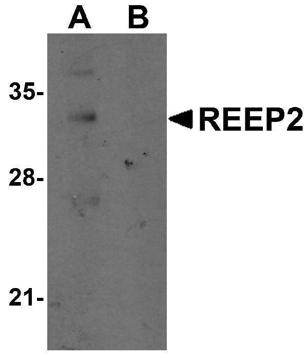 a11618 reep2 primary antibodies wb testing 1