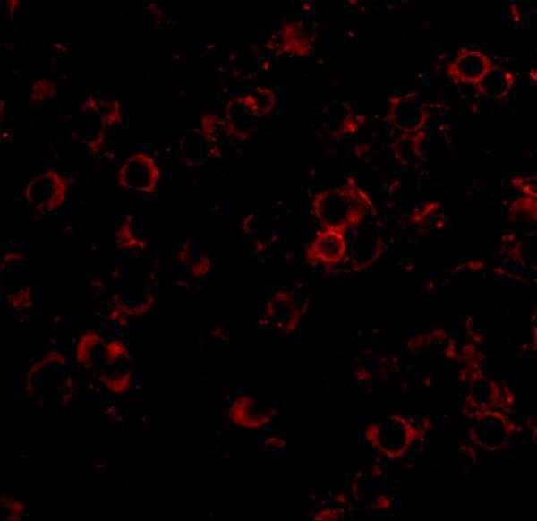 Immunofluorescence of LRFN2 in mouse brain tissue with LRFN2 antibody at 20 μg/mL
