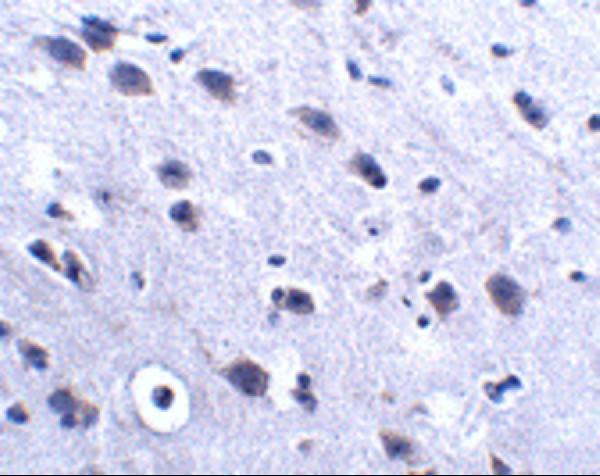 Immunohistochemistry of LRFN2 in mouse brain tissue with LRFN2 antibody at 2