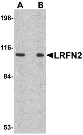 Western blot analysis of LRFN2 in rat brain lysate with LRFN2 antibody at (A) 1 and (B) 2 μg/mL