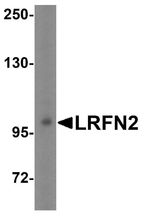 a11623 lrfn2 primary antibodies wb testing 4