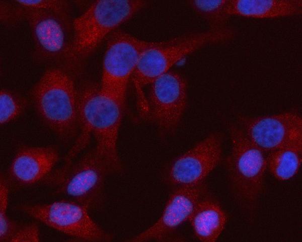 Figure 2. IF analysis of RASSF8 using anti-RASSF8 antibody (A11627-1). RASSF8 was detected in an immunocytochemical section of HELA cells. Enzyme antigen retrieval was performed using IHC enzyme antigen retrieval reagent (AR0022) for 15 mins. The cells were blocked with 10% goat serum. And then incubated with 5 microg/mL rabbit anti-RASSF8 Antibody (A11627-1) overnight at 4°C. Cy3 Conjugated Goat Anti-Rabbit IgG (BA1032) was used as secondary antibody at 1:500 dilution and incubated for 30 minutes at 37°C. The section was counterstained with DAPI. Visualize using a fluorescence microscope and filter sets appropriate for the label used.