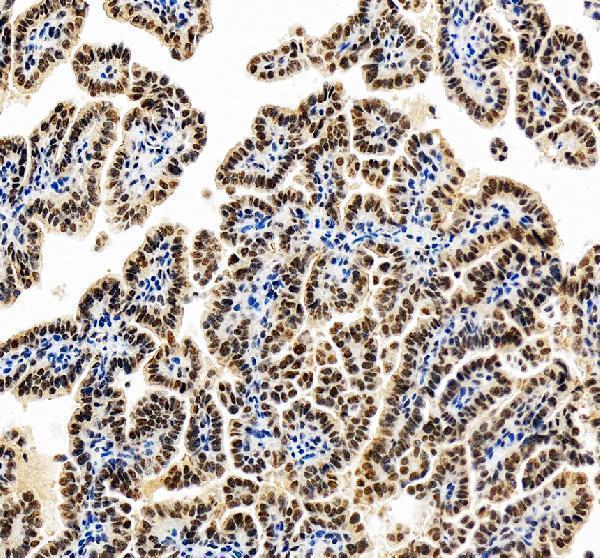 IHC analysis of RASSF8 using anti-RASSF8 antibody (A11627-1)