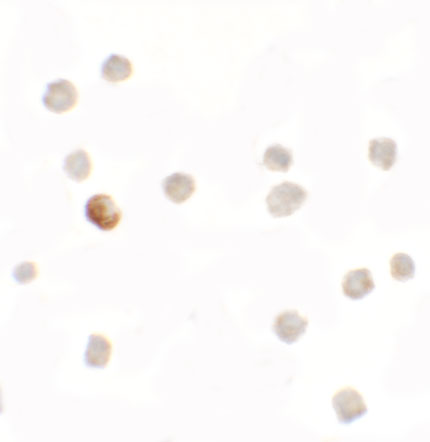 Immunocytochemistry of SDHAF1 in 3T3 cells with SDHAF1 antibody at 5 μg/mL