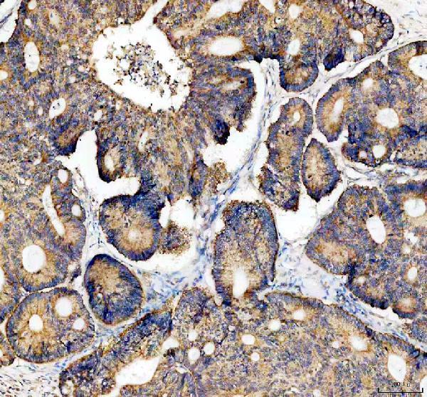 IHC analysis of MRPL23 using anti-MRPL23 antibody (A11634-1)