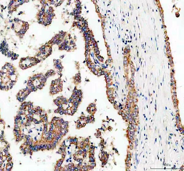 IHC analysis of MRPL23 using anti-MRPL23 antibody (A11634-1)