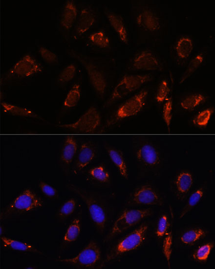 a11634 mrpl23 primary antiboties if testing 4