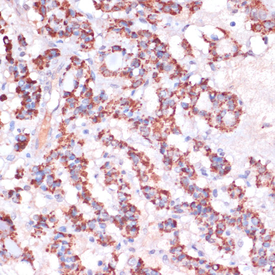 a11634 mrpl23 primary antiboties ihc testing 2