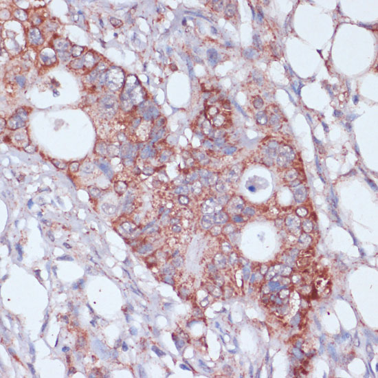 a11634 mrpl23 primary antiboties ihc testing 3