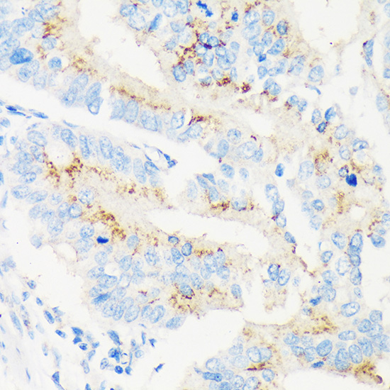a11639 man1a2 primary antiboties ihc testing 2