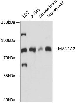 a11639 man1a2 primary antiboties wb testing 1