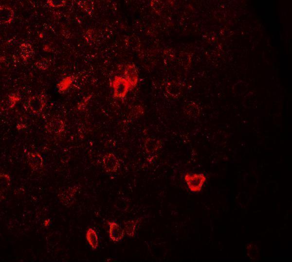 Immunofluorescence of CNRIP1 in rat brain tissue with CNRIP1 antibody at 20 μg/ml