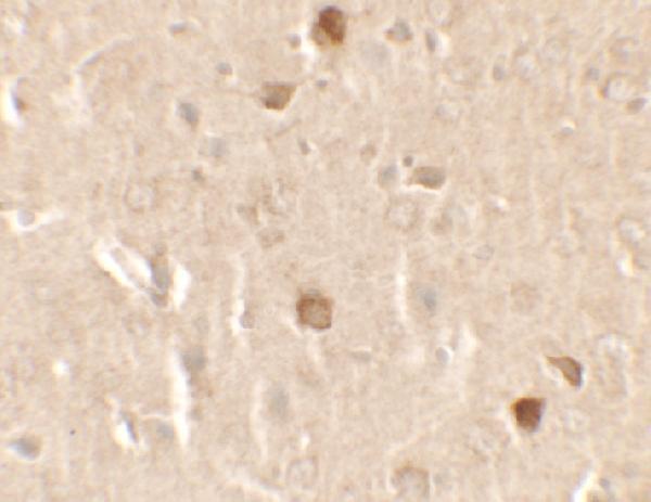 Immunohistochemistry of CNRIP1 in rat brain tissue with CNRIP1 antibody at 2