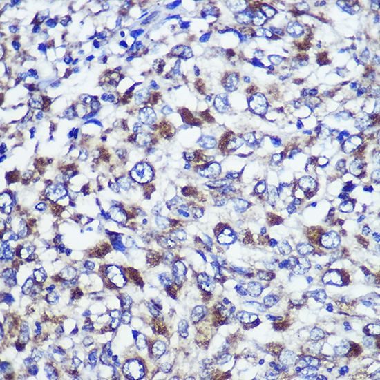 a11644 dis3l primary antiboties ihc testing 2