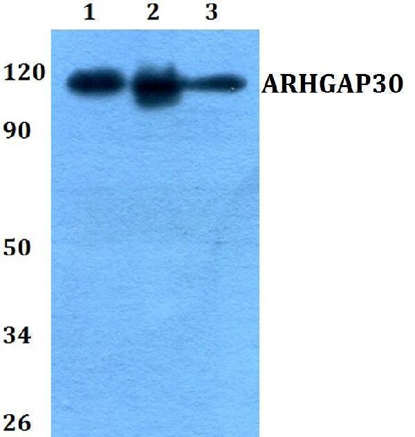 a11645 arhgap30 primary antiboties wb testing 1