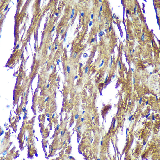 a11650 ndufaf4 primary antiboties ihc testing 2