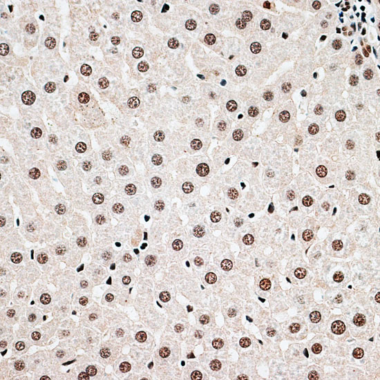 Immunohistochemistry of paraffin-embedded rat liver using CBX6 antibody  at dilution of 1:100 