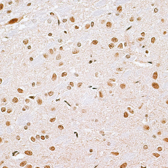 Immunohistochemistry of paraffin-embedded rat brain using CBX6 antibody  at dilution of 1:100 