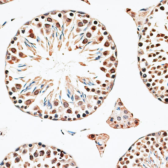 a11651 1 cbx6 primary antiboties ihc testing 4