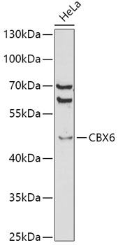 Western blot analysis of extracts of HeLa cells, using CBX6 antibody  at 1:1000 dilution
