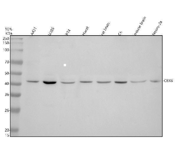 Western blot analysis of CBX6 using anti-CBX6 antibody (A11651-2)
