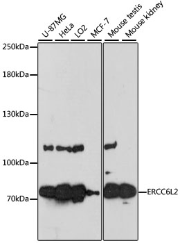 a11654 ercc6l2 primary antiboties wb testing 1