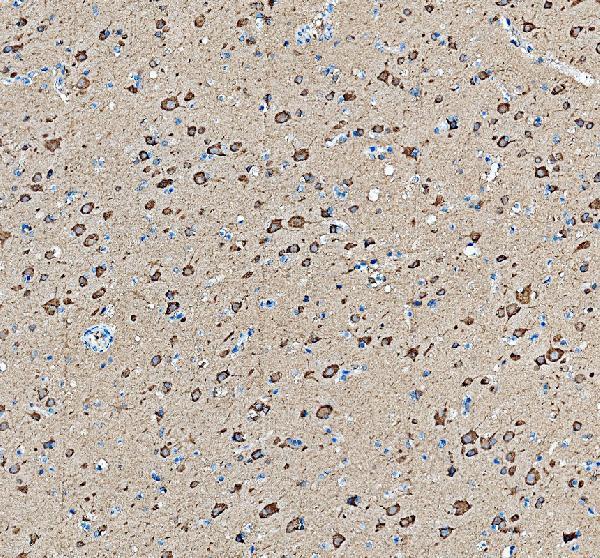 IHC analysis of FARSB using anti-FARSB antibody (A11656-2)