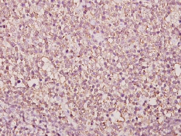 Immunohistochemistry (IHC) analyzes of BUD31 (E24) pAb in paraffin-embedded human tonsil carcinoma tissue at 1:50