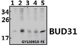 Western blot (WB) analysis of BUD31 (E24) polyclonal antibody at 1:500 dilution
Lane1:A375 whole cell lysate(40ug)
Lane2:HEK293T whole cell lysate(40ug)
Lane3:SGC7901 whole cell lysate(40ug)
Lane4:C6 whole cell lysate(40ug)
Lane5:3T3-L1 whole cell lysate(40ug)
