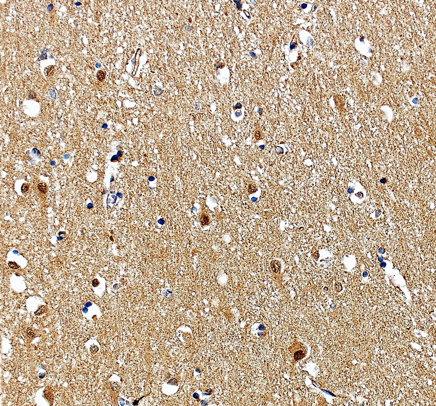 a11666 1 myef2 primary antibodies ihc testing 1