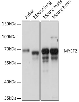 a11666 myef2 primary antiboties wb testing 1