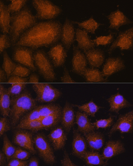 a11667 gstt2b primary antiboties if testing 2