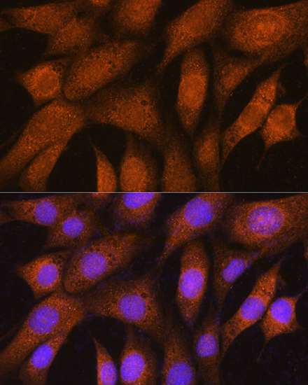 a11667 gstt2b primary antiboties if testing 3
