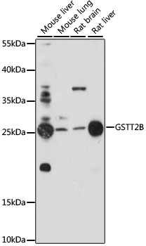 a11667 gstt2b primary antiboties wb testing 1